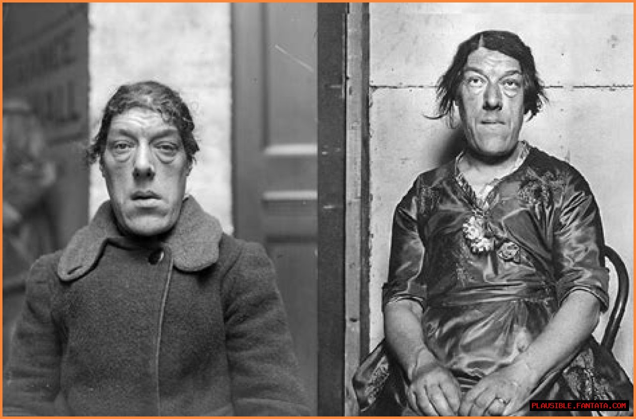 The Surprising Truth About Being Dubbed The Ugliest Person In The World